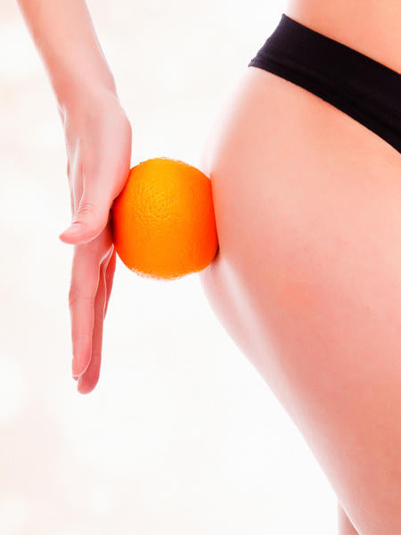 5 Mythen über Cellulite